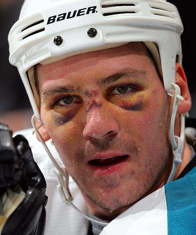 140424154249-primeau-vinnick-single-image-cut.jpg